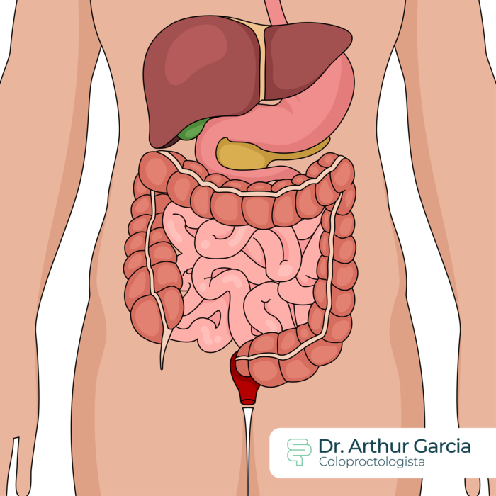 Perianal Crohn's